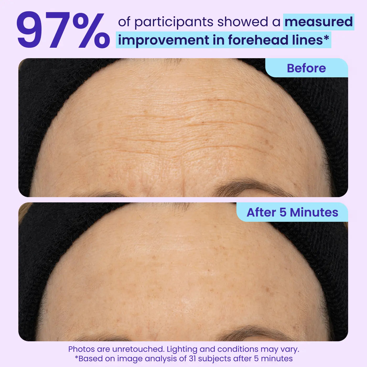 Final 3 Hours: 60%OFF🔥 Instant Lift Eye Gel for Puffiness, Bags & Dark Circles-HS