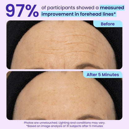 Final 3 Hours: 60%OFF🔥 Instant Lift Eye Gel for Puffiness, Bags & Dark Circles-HS