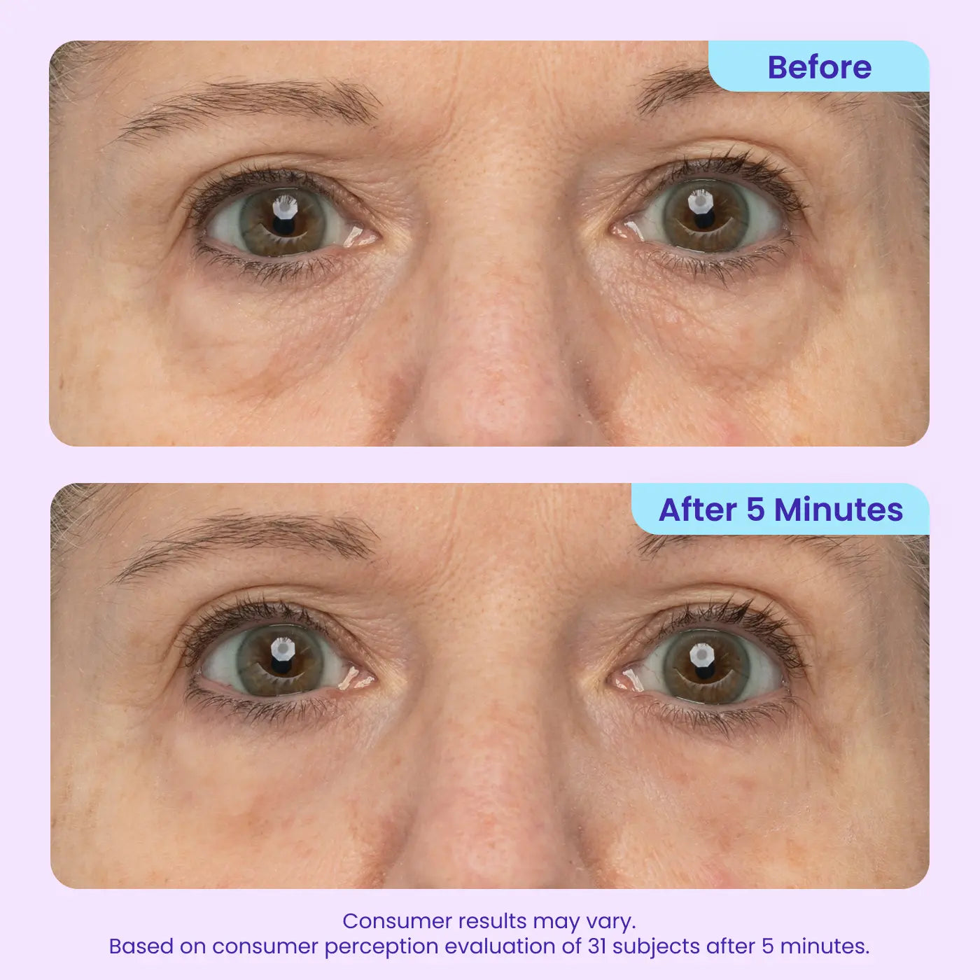 Final 3 Hours: 60%OFF🔥 Instant Lift Eye Gel for Puffiness, Bags & Dark Circles-HS