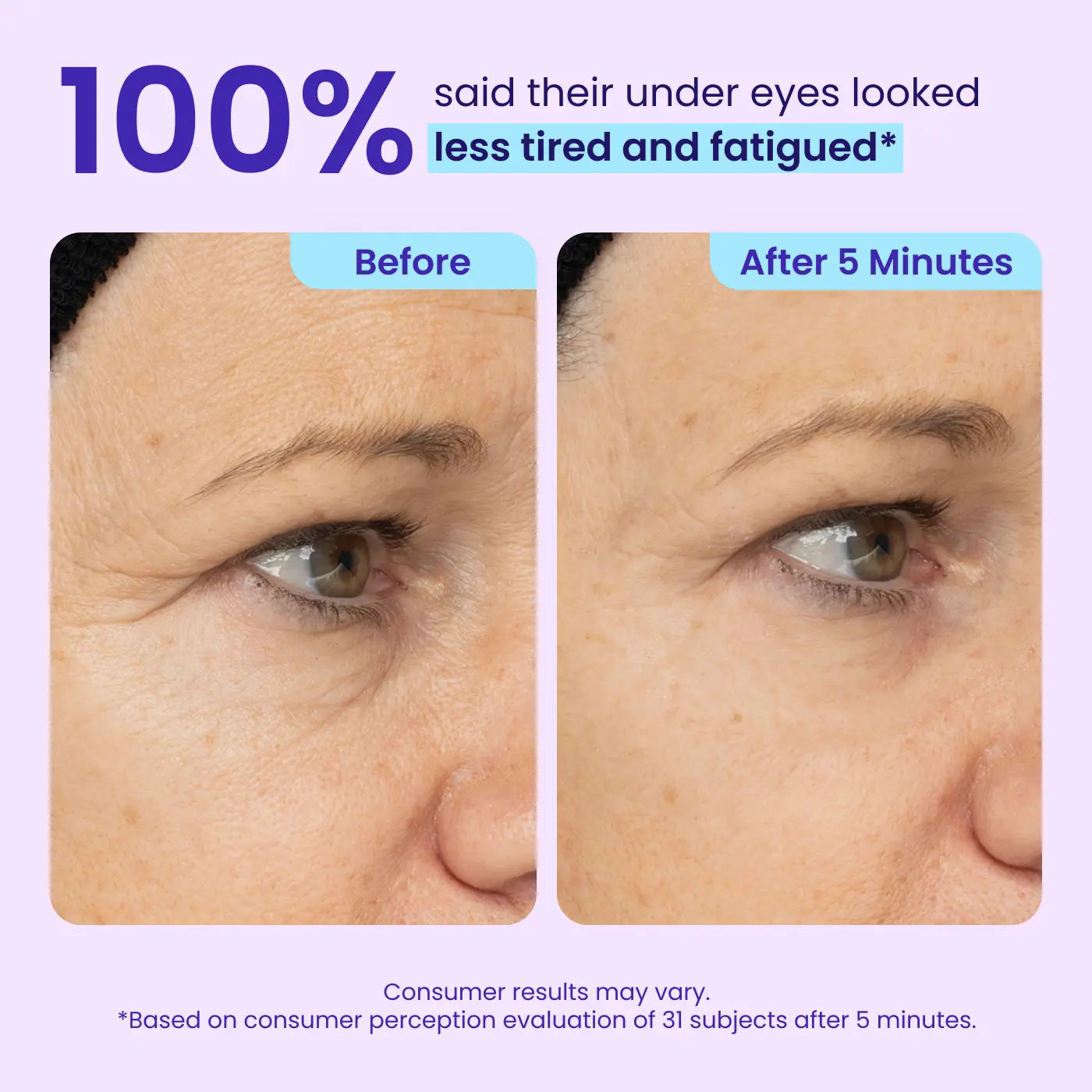 Final 3 Hours: 60%OFF🔥 Instant Lift Eye Gel for Puffiness, Bags & Dark Circles-HS