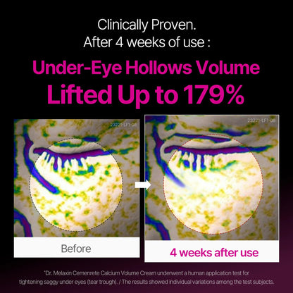 Korean Calcium Dark Spot Eye Cream-HS
