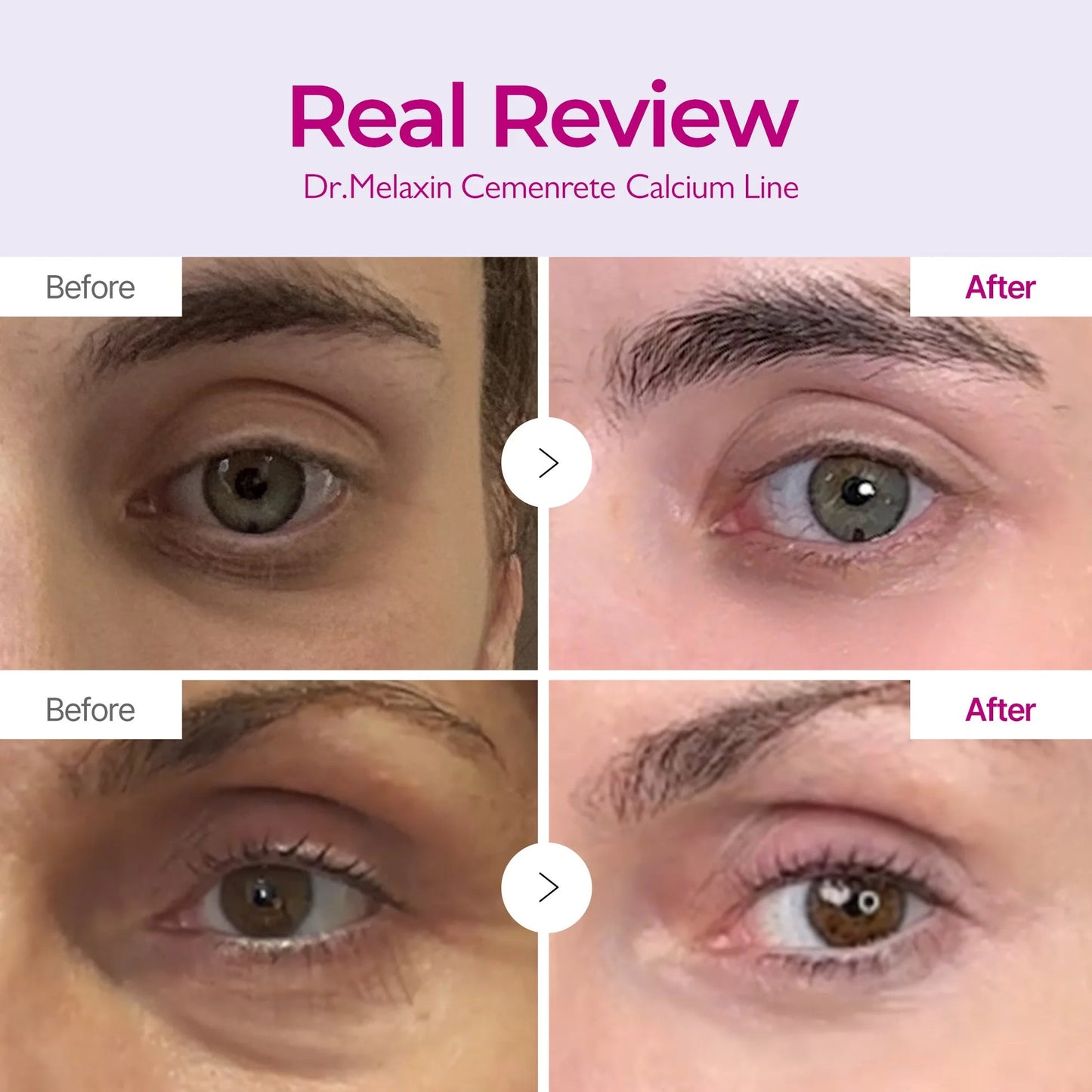 Korean Calcium Dark Spot Eye Cream-HS