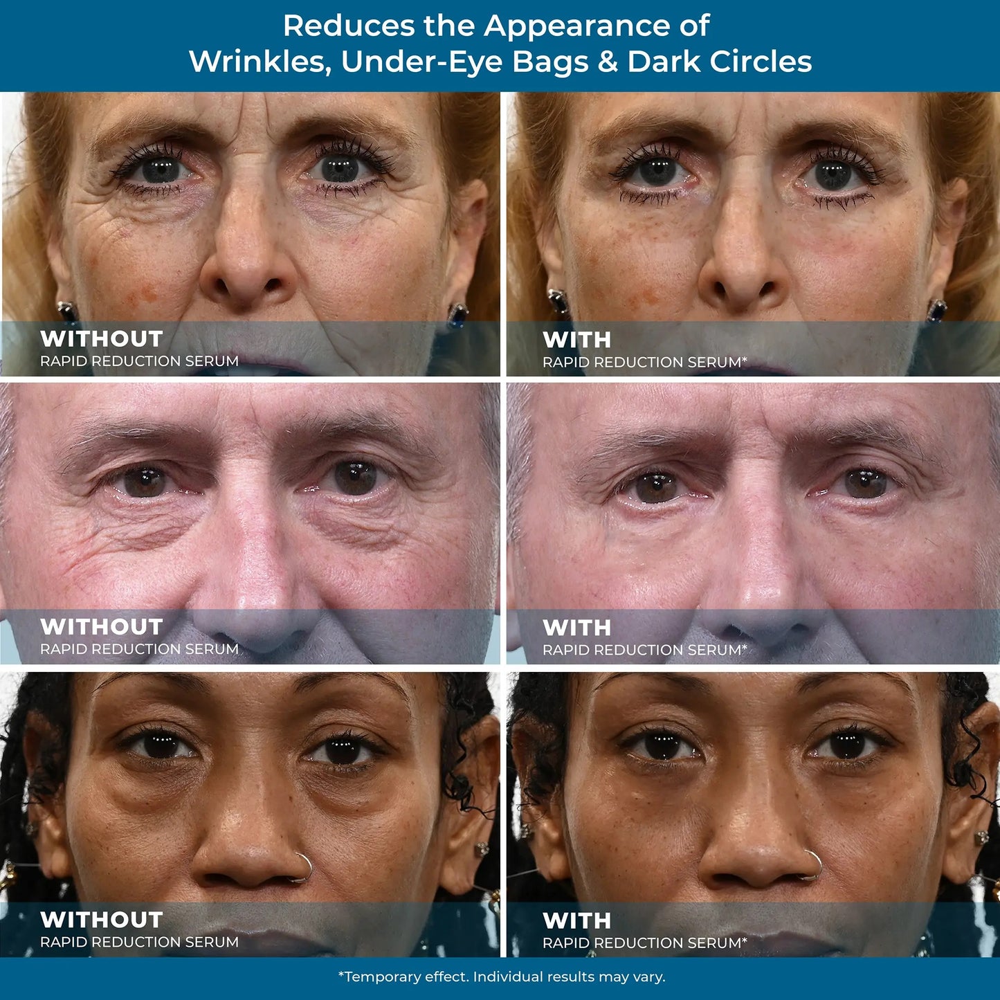 Sérum para ojos de reducción rápida Plexaderm - Removedor de arrugas antienvejecimiento para el rostro, fórmula científica para una fácil absorción sin dejar sensación grasosa, 10 ml, cuidado de la piel reafirmante Comfort-HS
