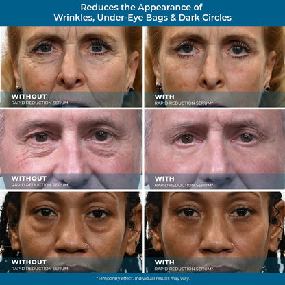 Sérum para ojos de reducción rápida Plexaderm - Removedor de arrugas antienvejecimiento para el rostro, fórmula científica para una fácil absorción sin dejar sensación grasosa, 10 ml, cuidado de la piel reafirmante Comfort-HS