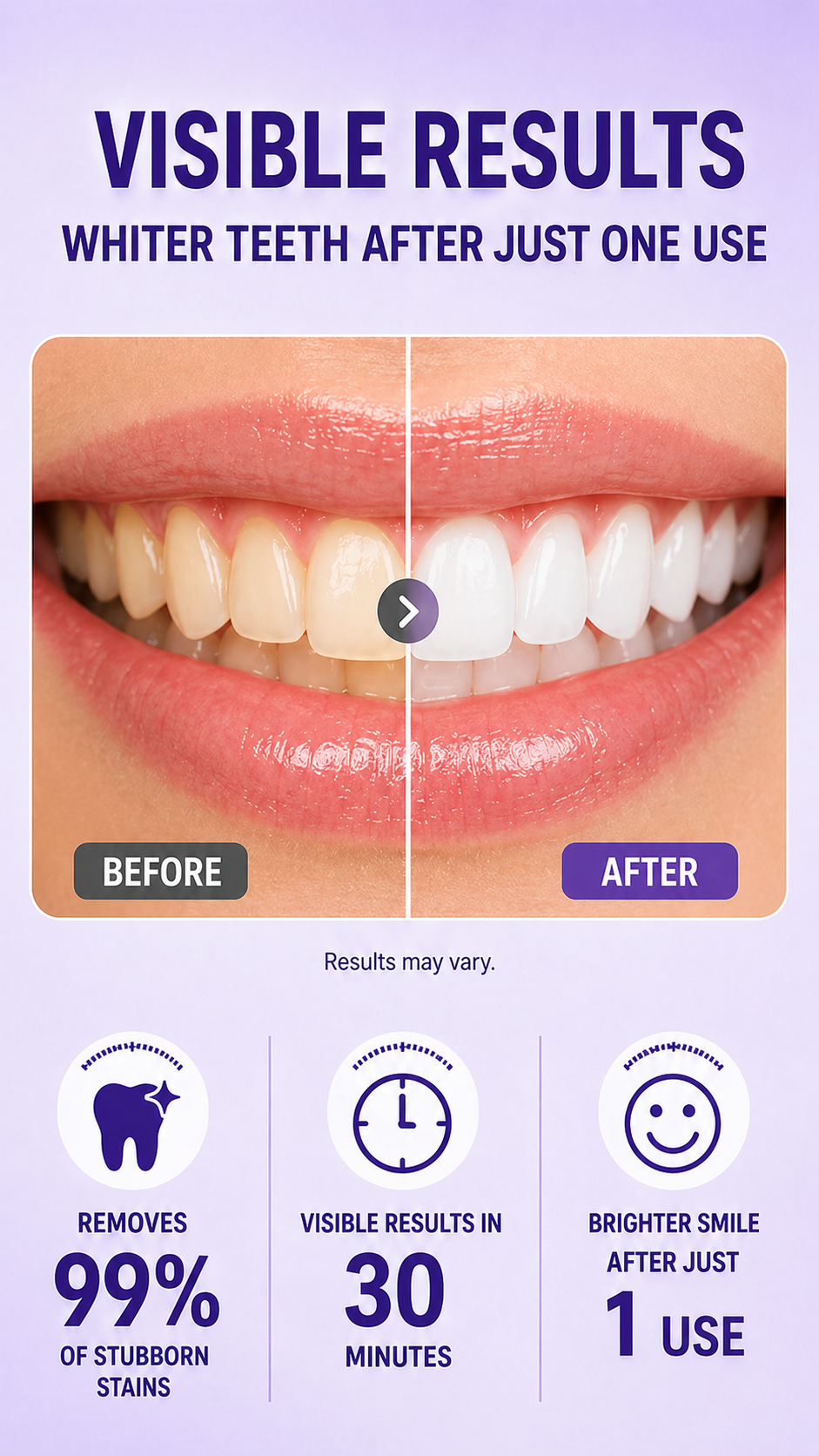 Purple Whitening Strips，Instant Bright White Teeth，Remove Yellow Stains Fast-HS