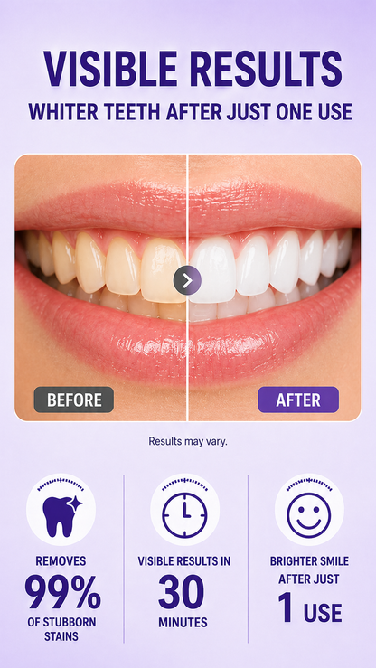 Purple Whitening Strips，Instant Bright White Teeth，Remove Yellow Stains Fast-HS