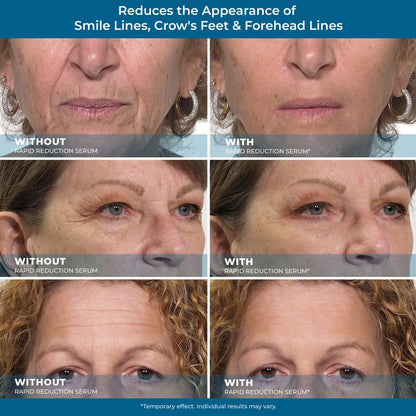 Sérum para ojos de reducción rápida Plexaderm - Removedor de arrugas antienvejecimiento para el rostro, fórmula científica para una fácil absorción sin dejar sensación grasosa, 10 ml, cuidado de la piel reafirmante Comfort-HS